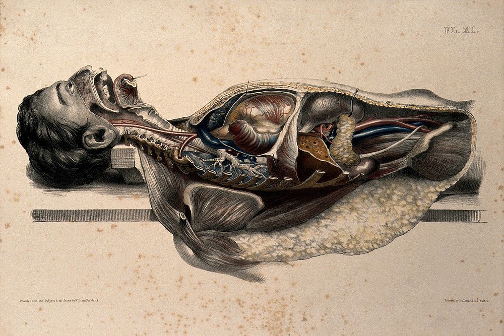 The body of a man lying down, with his face and trunk dissected to reveal the ribs and viscera. Coloured lithograph by…
