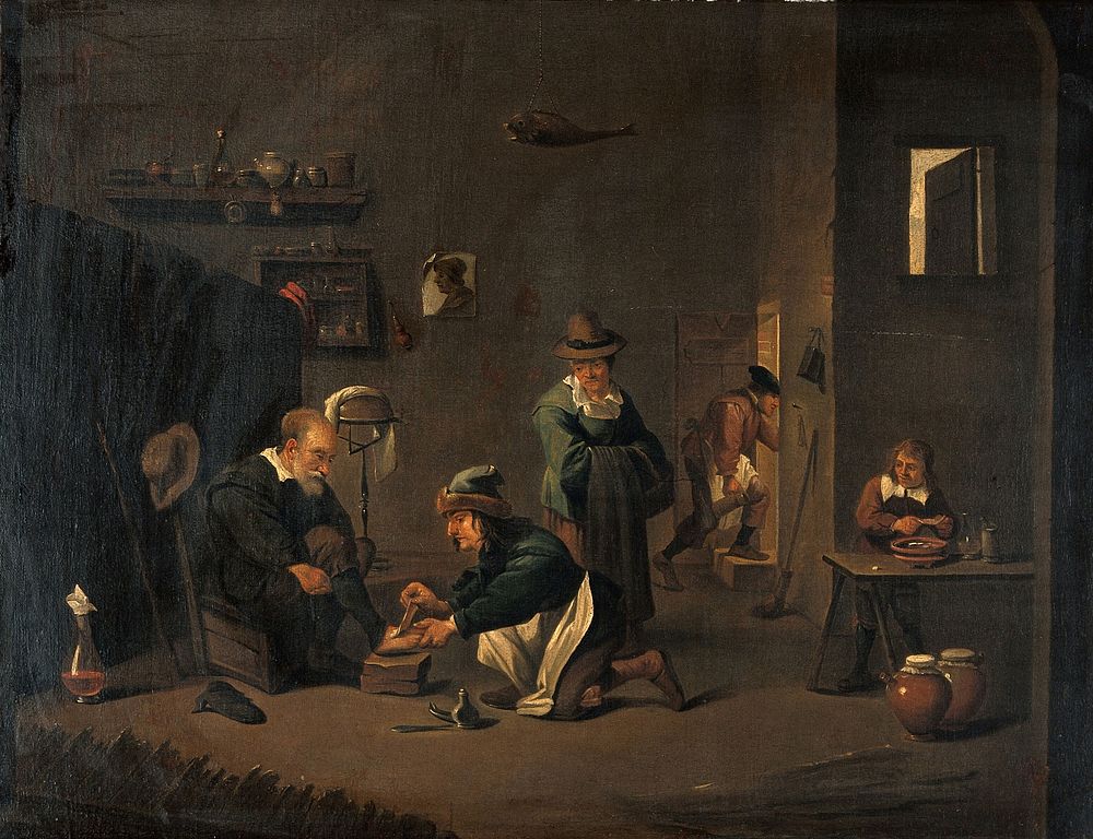 A surgeon removing a plaster from a man's foot. Oil painting by a follower of David Teniers the younger.