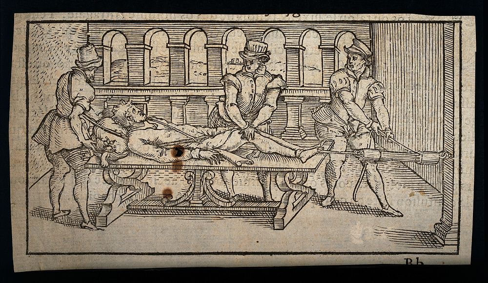 A surgeon and two assistants using pulleys and ropes to aid traction for manipulating the body of a male patient. Woodcut…