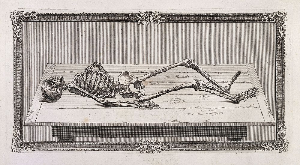 A skeleton showing the diseased bones of the body.