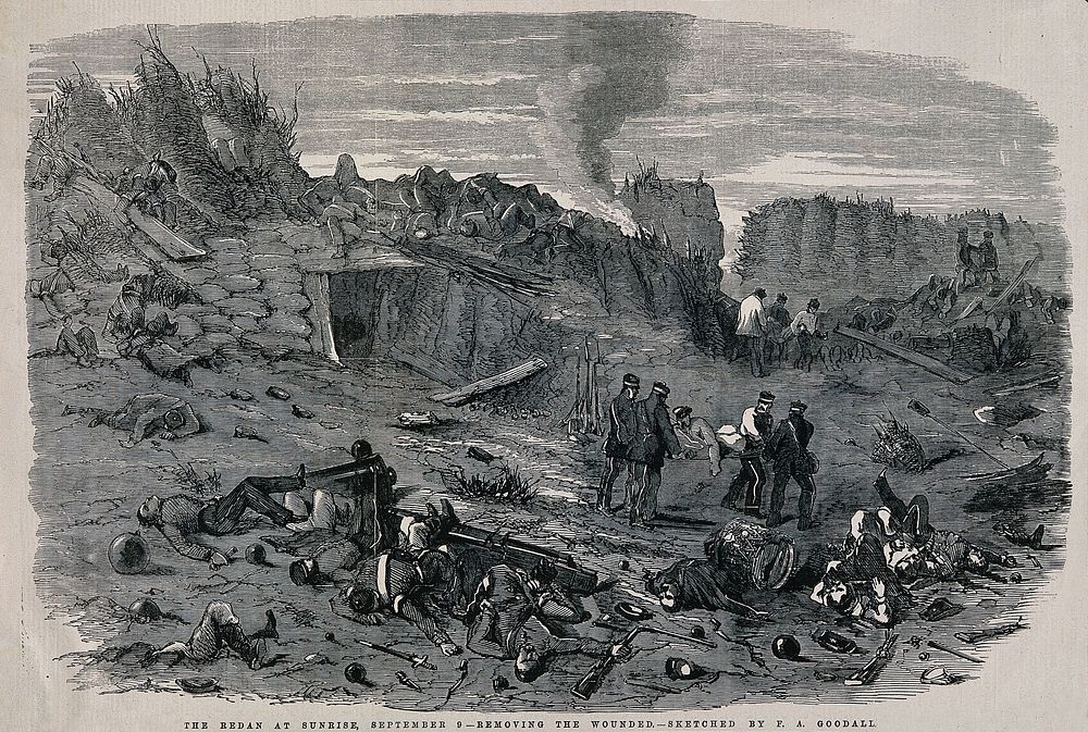 Crimean War: removing the wounded from the Redan. Wood engraving by E.A. Goodall.