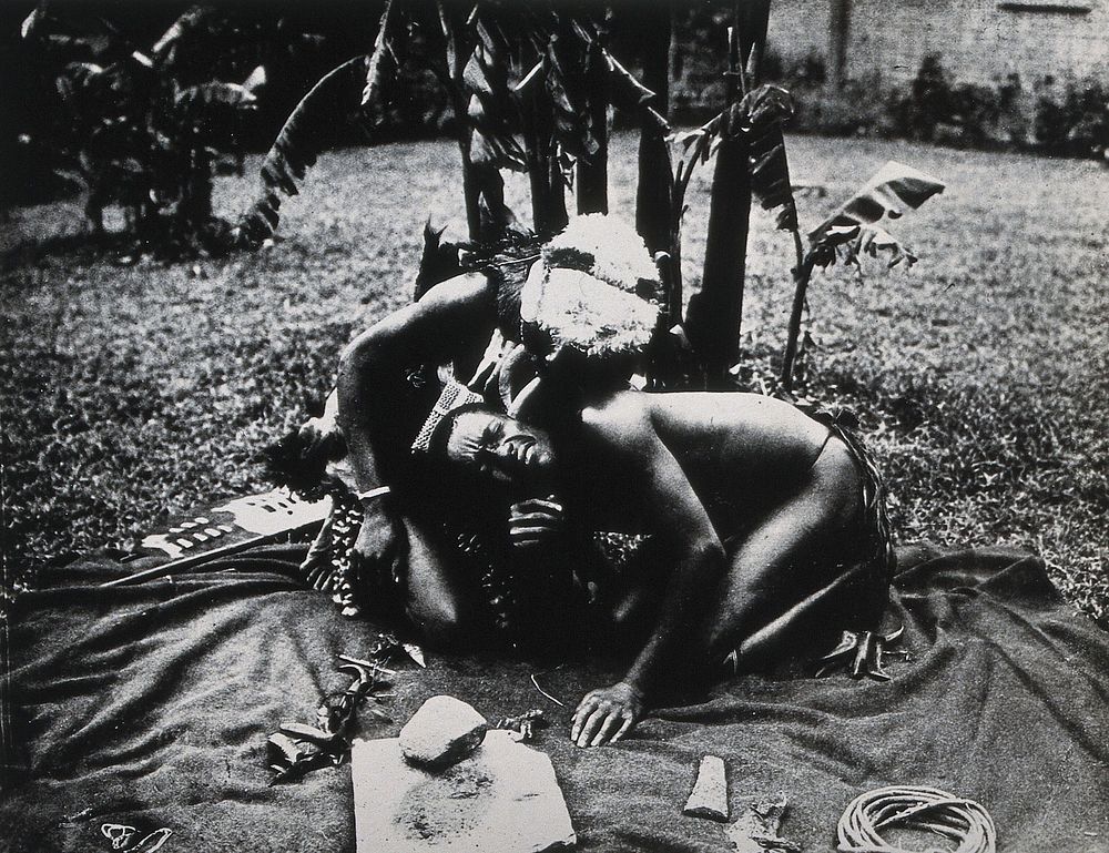 South Africa: a Zulu medicine man drawing a patient's blood by cupping . Photograph after a photograph, ca. 1907.