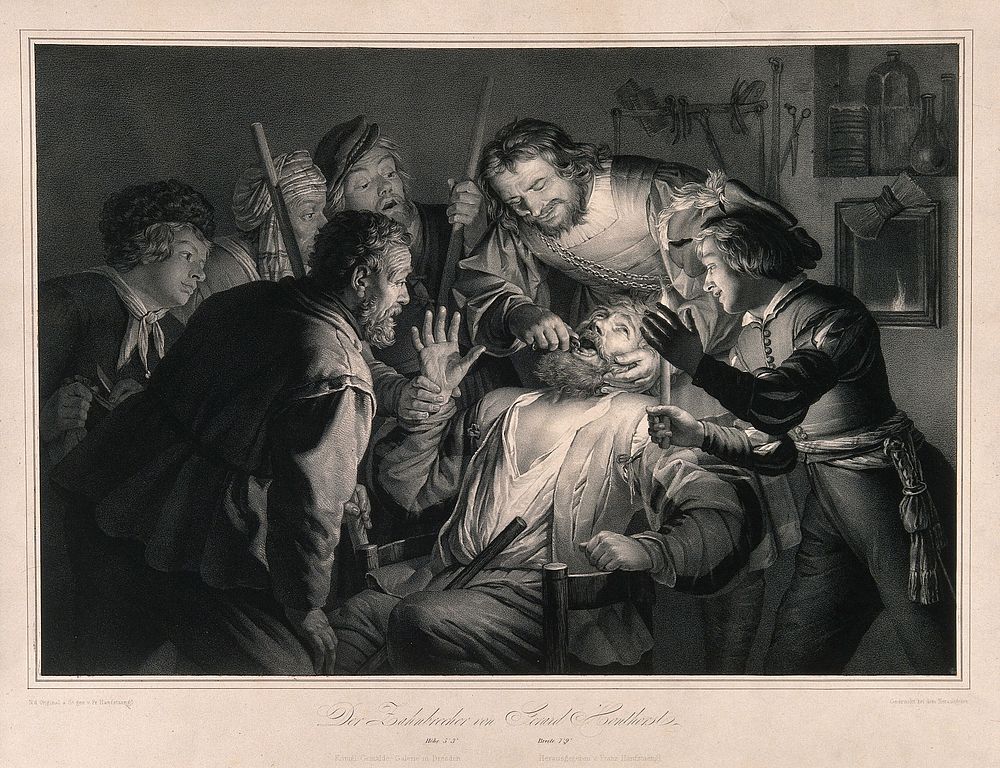 A tooth-drawer in his practice extracting a tooth from a seated patient who is surrounded by friends and family holding…