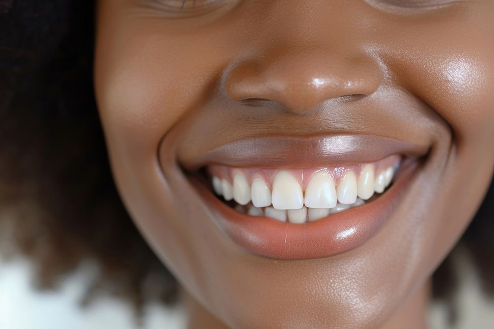 African American woman showing smile on camera teeth skin perfection.