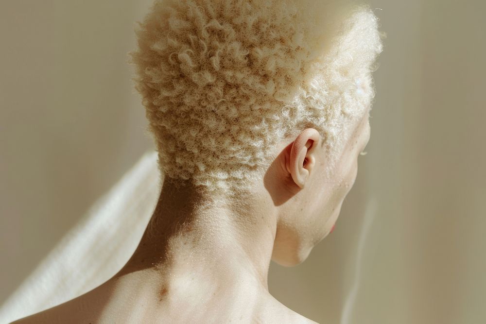 Woman with albinism model hairstyle headshot portrait.