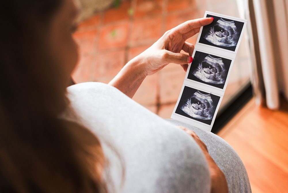 Pregnant woman holding ultrasound images, viewing baby scans. Expectant mother admiring ultrasound photos, anticipating…