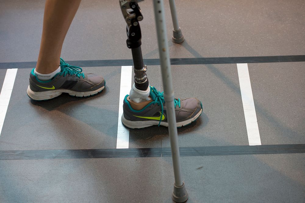 Air Force Capt. Christy Wise practices walking with an artificial limb as she recovers from an above-knee amputation at the…