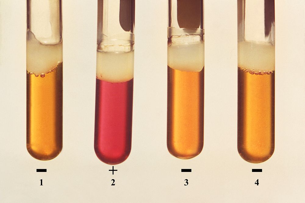 Four test tubes of bacterial microorganism. Original image sourced from US Government department: Public Health Image…