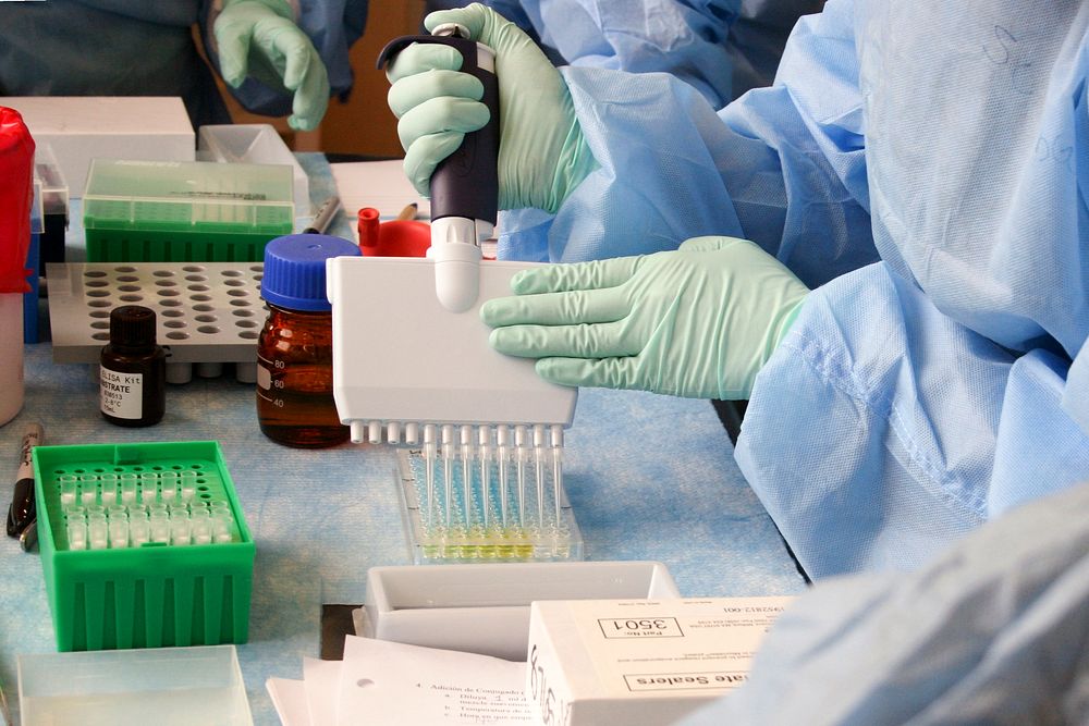 Lab technician adding a solution to an Enzyme&ndash;Linked Immunosorbent Assay (ELISA) plate Original image sourced from US…