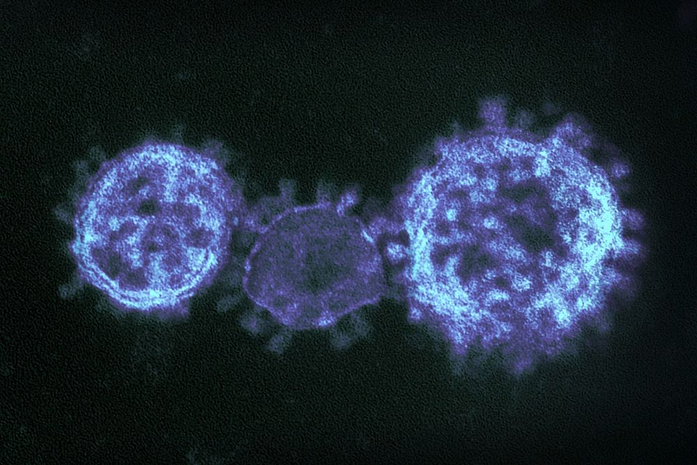 MERS Coronavirus Particles&ndash;Colorized transmission electron micrograph showing particles of the Middle East respiratory…