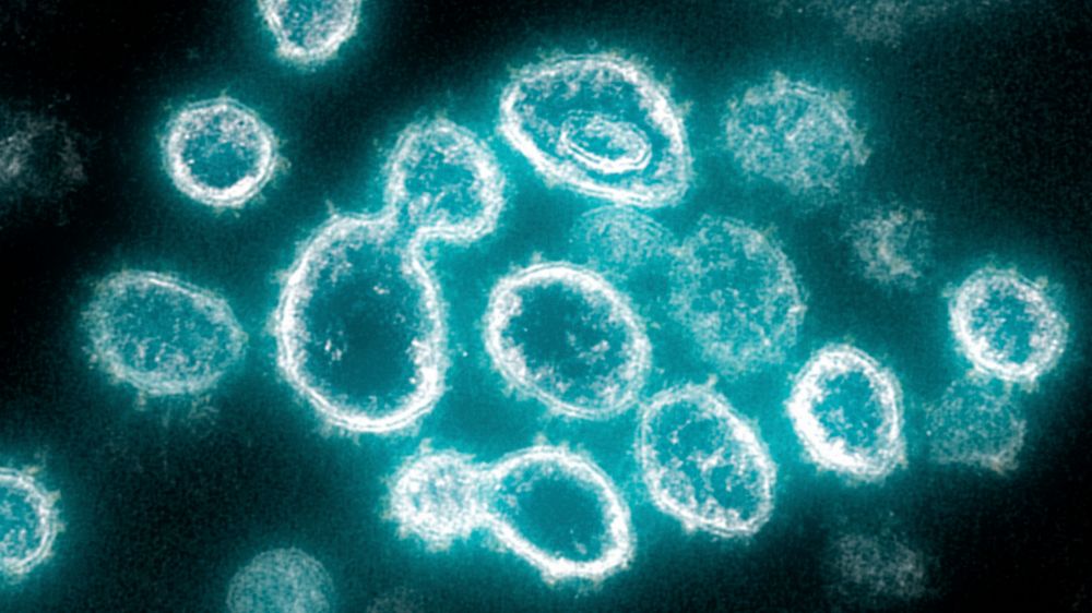 Novel Coronavirus 2019-nCoV electron microscope