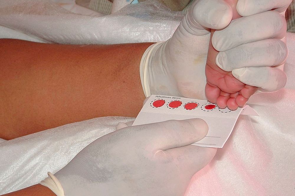A healthcare worker extracting a blood sample from the right big toe of an infant. Original image sourced from US Government…