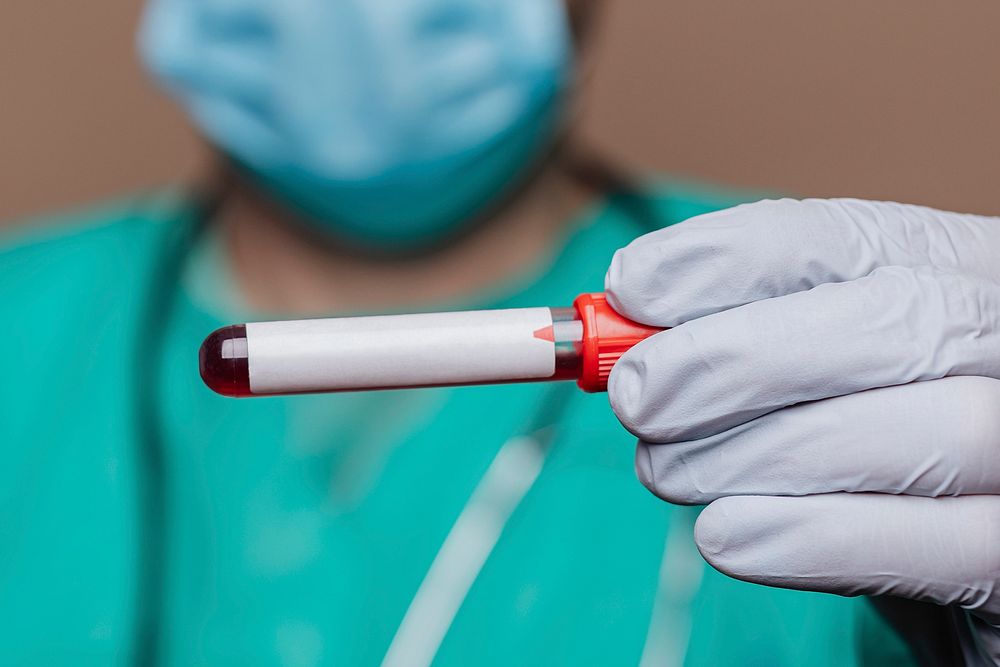 Surgeon wearing a mask holding a blood test tube