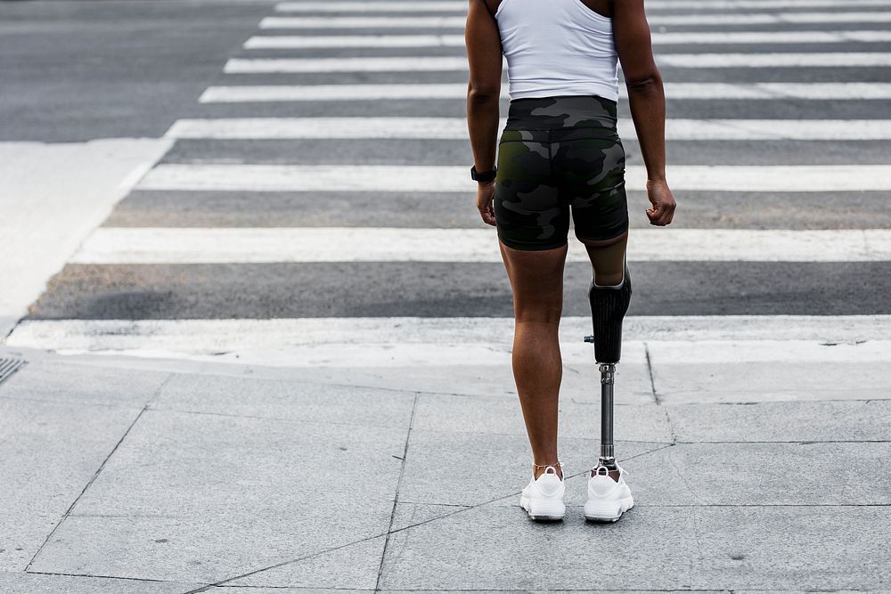 Woman with prosthetic standing by crosswalk