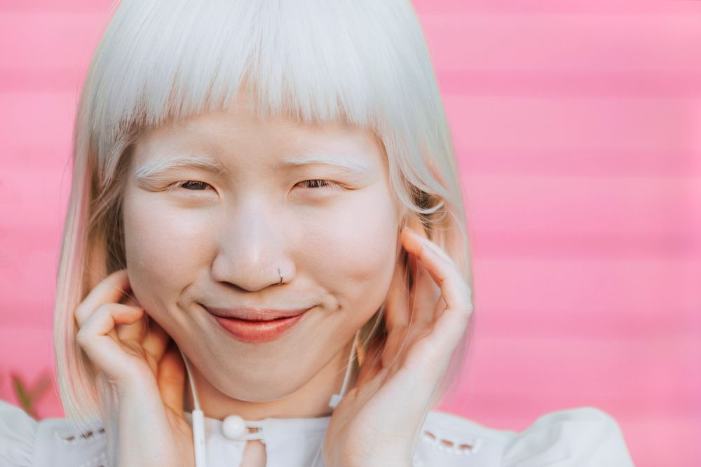 Cute Albino girl listening to music through earphones