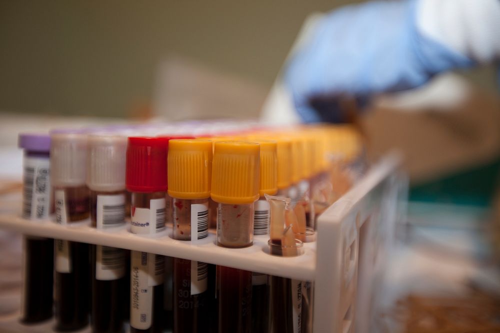 U.S. Army Spc. Erica Corley, with the Armed Services Blood Bank Center, organizes blood vials at Camp Kinser, Okinawa…