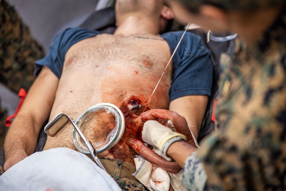 U.S. Marine Corps Forces, South puts the Tactical Scalable Surgical System to the Test. Original public domain image from…