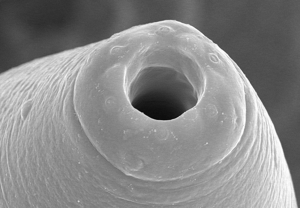 Each teaspoonful of health soil contains billions of soil microorganisms like the nematode seen here. Photo credit: USDA…