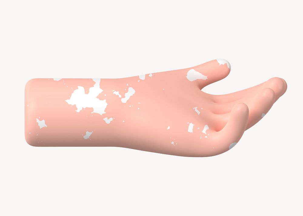 Helping hand gesture, vitiligo awareness, 3D illustration