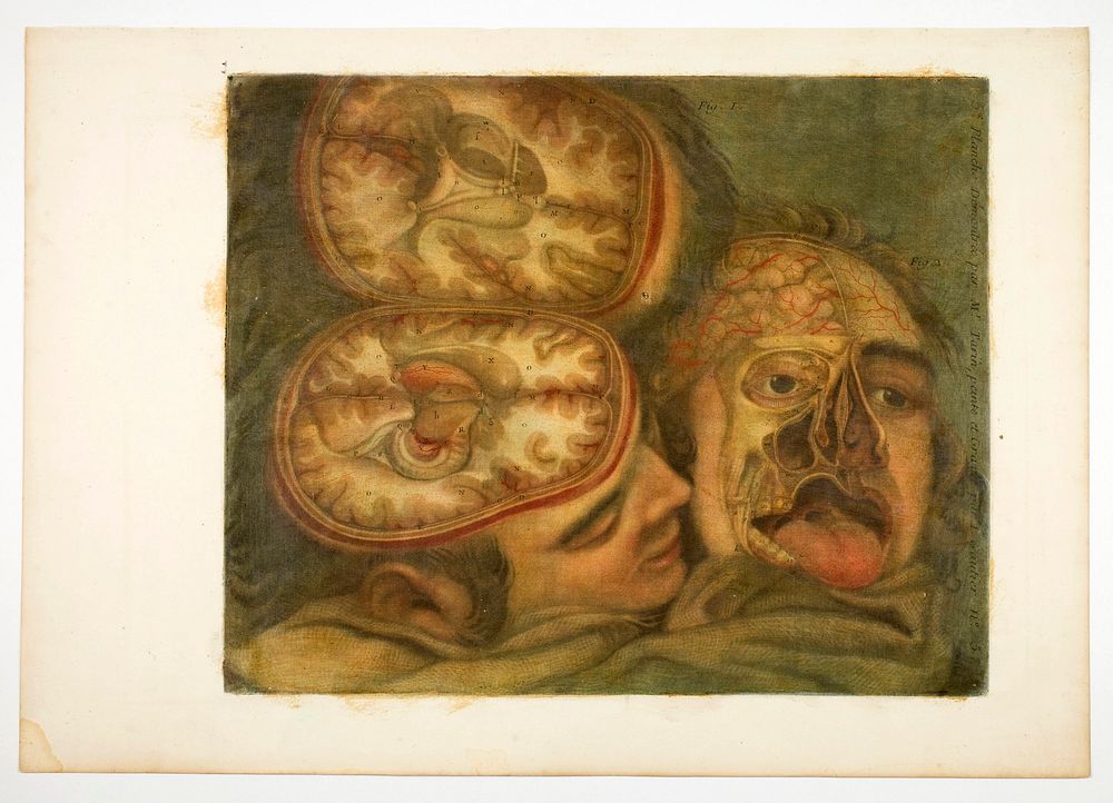 Cranial Dissection, plate five from Anatomy of the Head, in Printed Paintings by Jacques Fabien Gautier d'Agoty