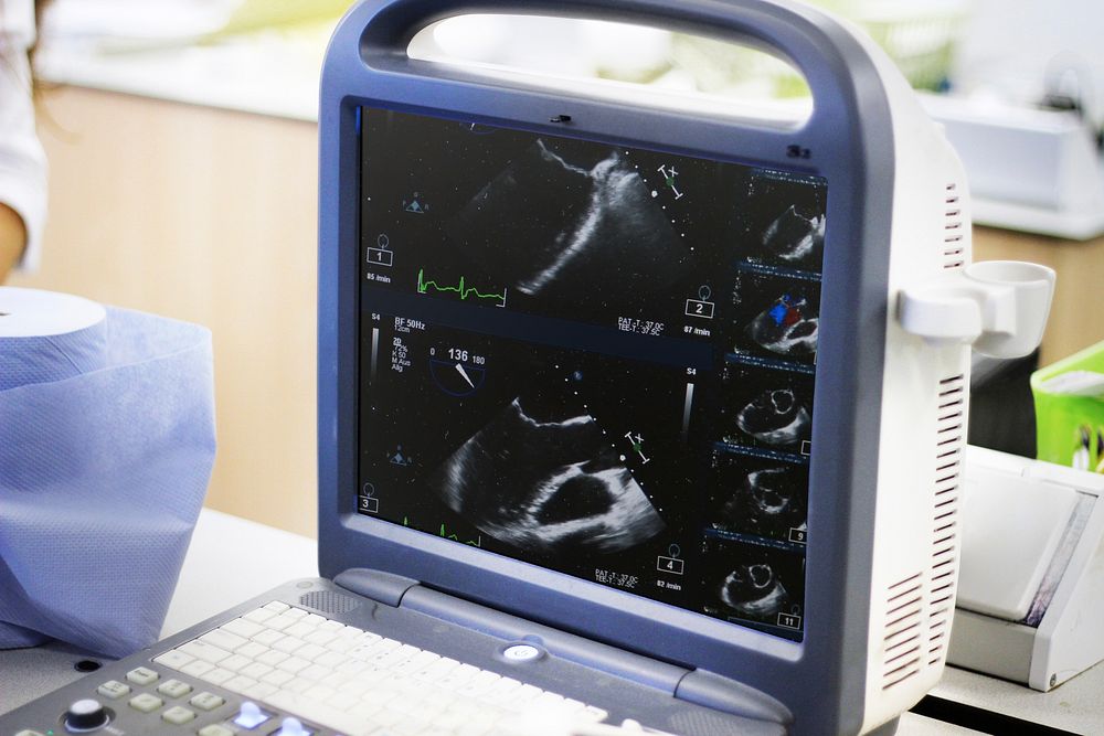 Ultrasound screen monitor for medical science 