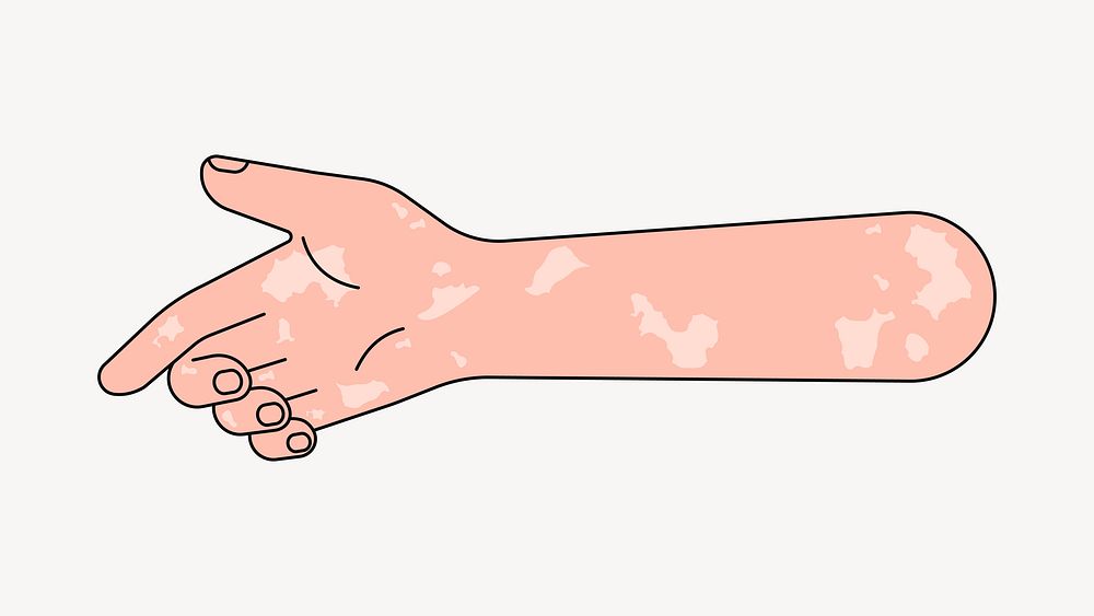 Reaching vitiligo hand, gesture collage element vector