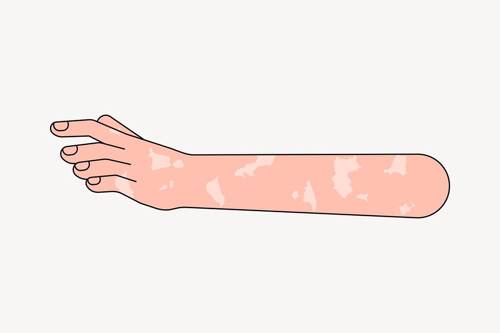Vitiligo hand reaching out, gesture collage element vector