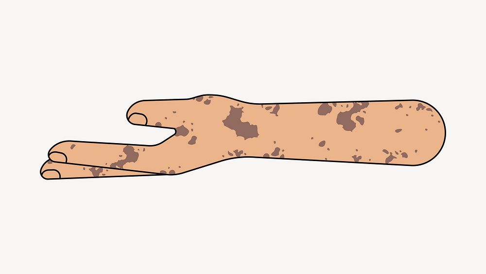 Vitiligo helping hand gesture, flat illustration