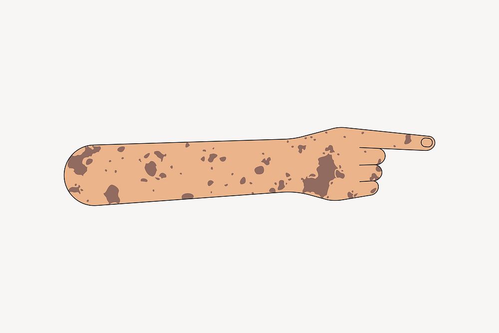 Vitiligo hand pointing finger, gesture collage element vector