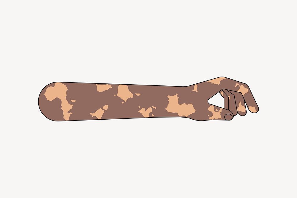 Black vitiligo hand gesture, flat collage element vector