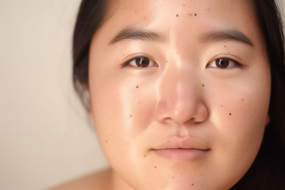 Freckle adult woman skin. AI generated Image by rawpixel.
