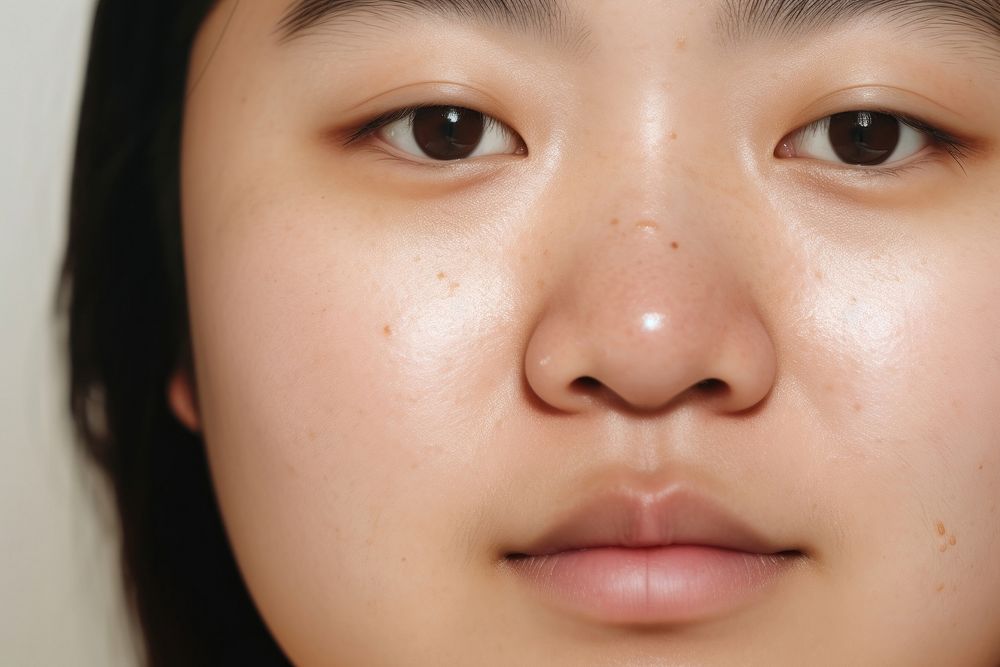 Chubby asian woman freckle skin eye. 