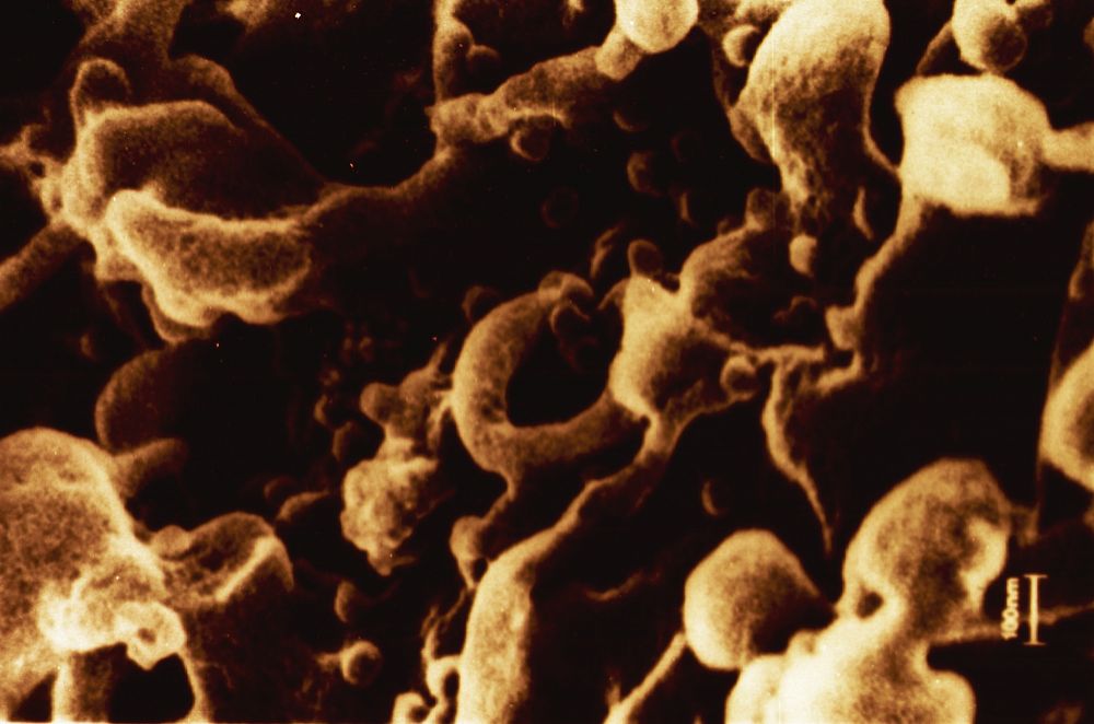 Microscopic view of the human immunodeficiency virus. Close-up of a microscopic view of the AIDS virus. Original public…