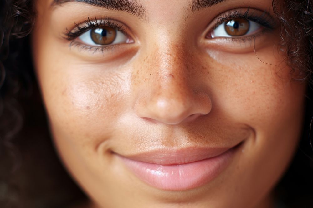 Freckle smiling skin face. 