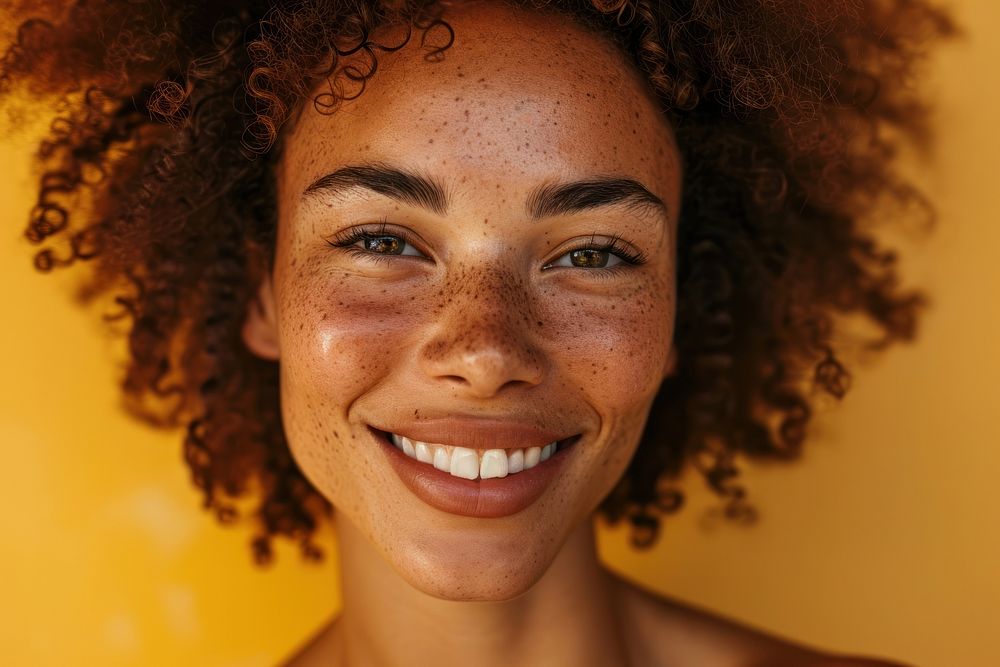 Woman vitiligo skin adult smile happy. AI generated Image by rawpixel.