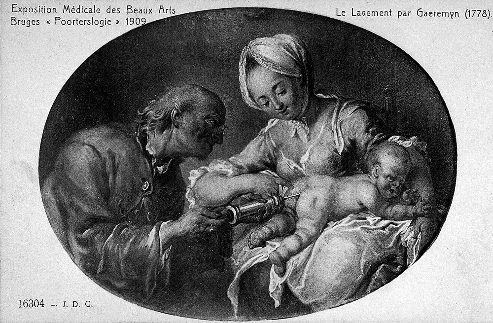 A man administers an enema to a baby. Reproduction of a painting by J.A. Garemyn, 1778.