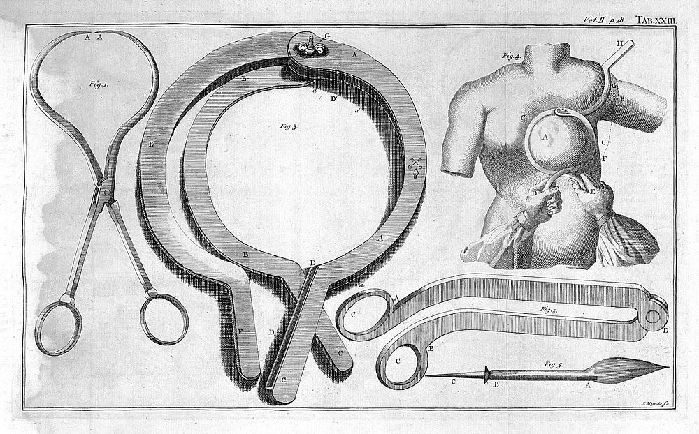 A general system of surgery in three parts : containing the doctrine and management: I. Of wounds, fractures, luxations…