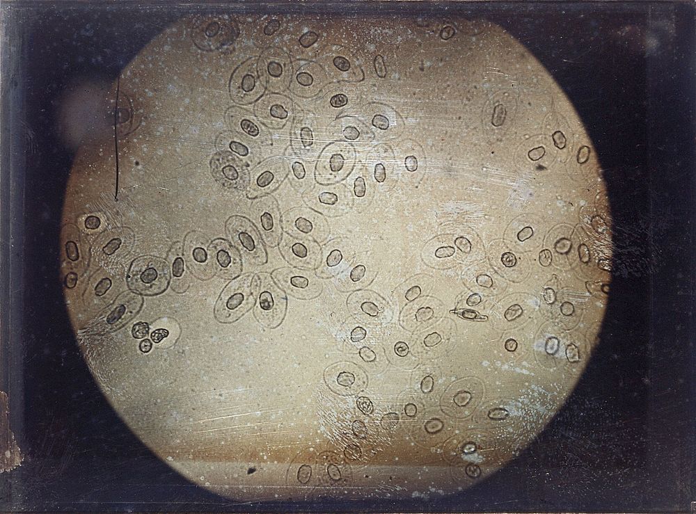 Blood corpuscles of a frog. Photomicrograph by Léon Foucault, 1844.