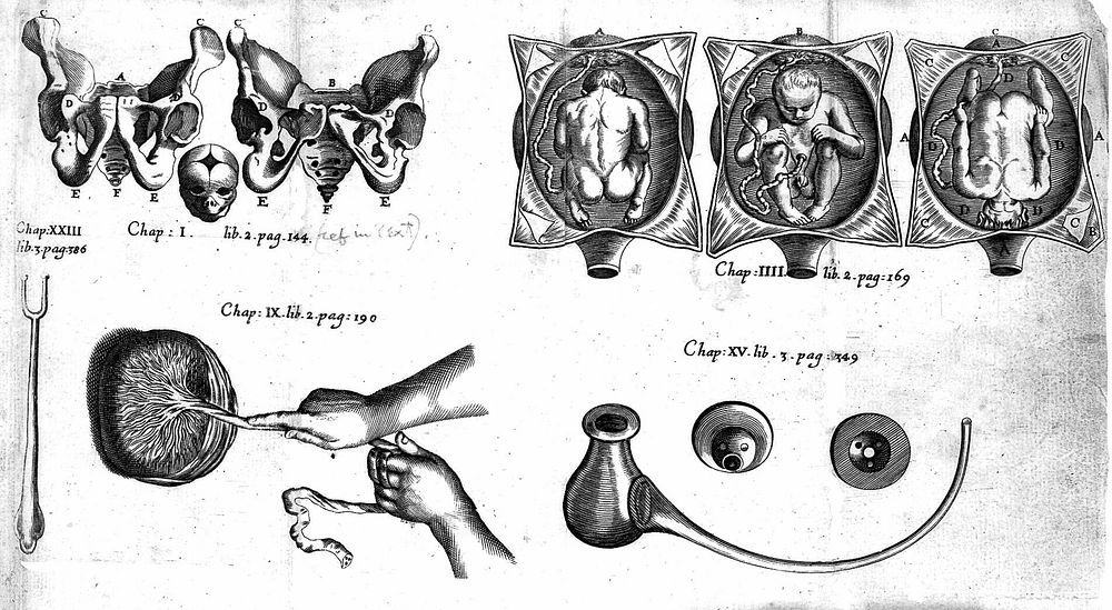 The accomplisht midwife, treating of the diseases of women with child, and in child-bed. As also, the best directions how to…