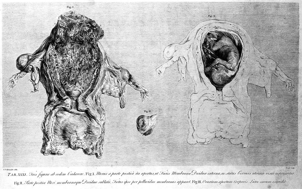 Anatomia uteri humani gravidi tabulis illustrata ... The anatomy of the human gravid uteris exhibited in figures / [William…