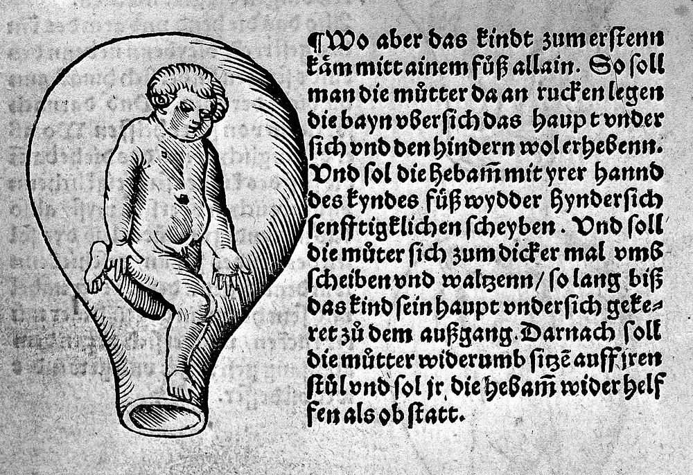 Der schwanngeren Frawen und Hebammen Rosengarte / [Eucharius Rösslin].