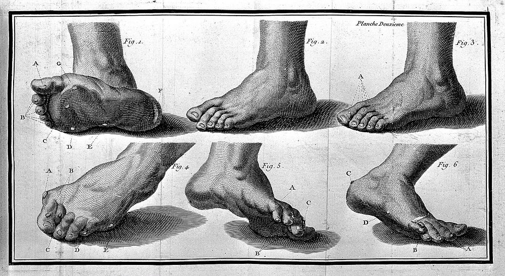 Plate showing the feet from La Forest, L'art de soigner les pieds.