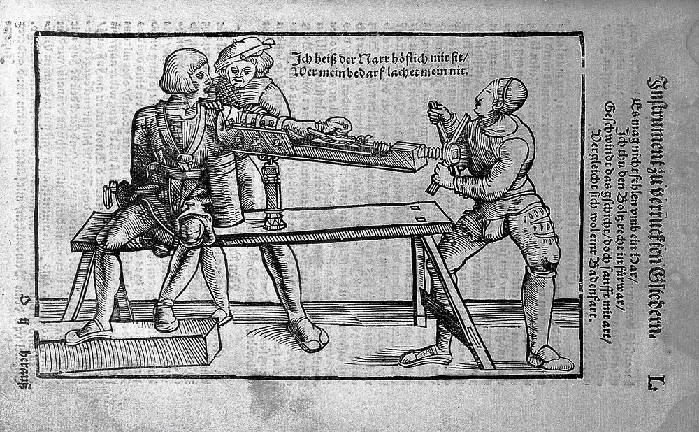 Gersdorff, Feldtbuch der Wundartzney, 1527
