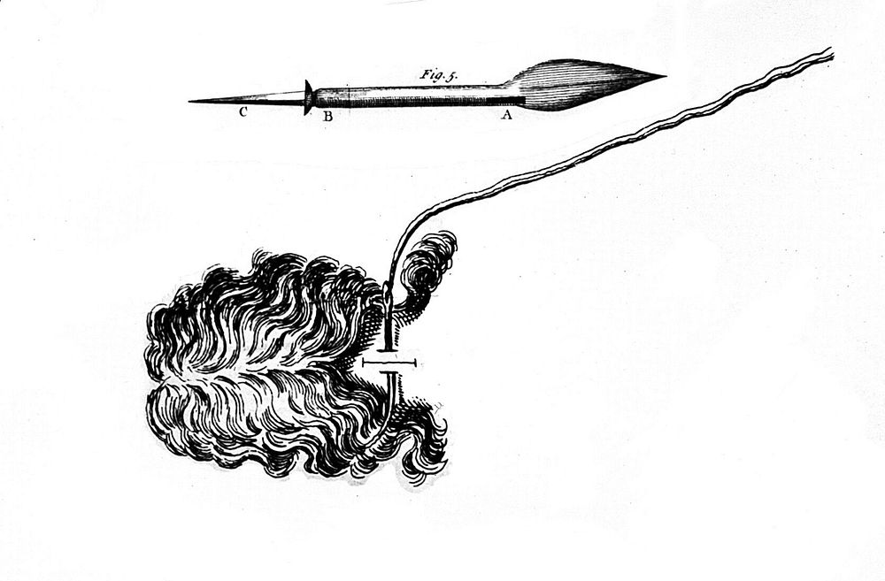 A general system of surgery in three parts : containing the doctrine and management: I. Of wounds, fractures, luxations…