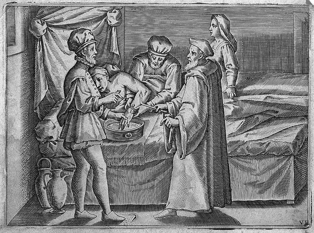 A surgeon consulting an older surgeon before bleeding an man's hand, he is aided by an assistant and a woman. Engraving…