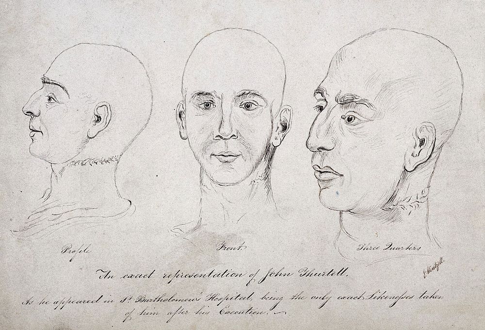 The head of John Thurtell after his hanging. Pen drawing by J. Wentzell, 1824.