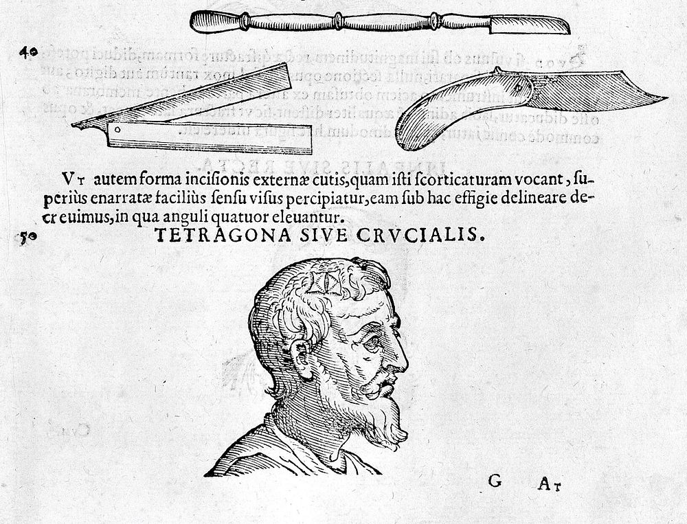 Chirurgiae ... libri septem, quamplurimis instrumentorum imaginibus arti chirurgicae opportunis suis locis exornata…