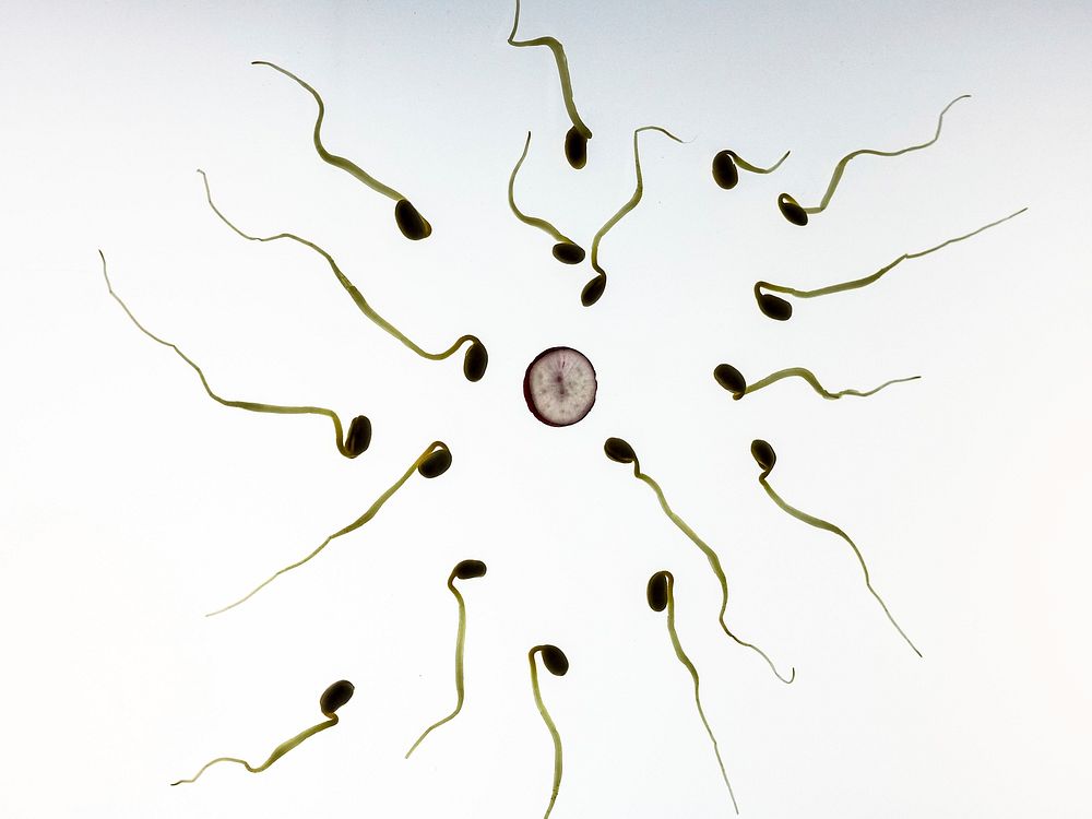 Free bean sprout, sperm concept photo, public domain pregnancy CC0 image.