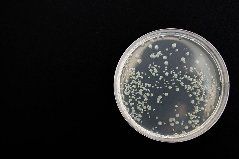 Free petri dish image, public domain science CC0 photo.
