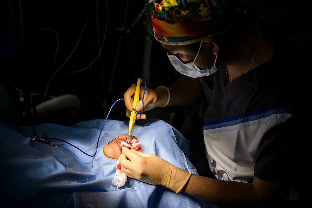 SUBIC BAY, Philippines (Aug. 9, 2015) Dr. Freemont Base, an Operation Smile volunteer, performs cleft lip surgery on a…